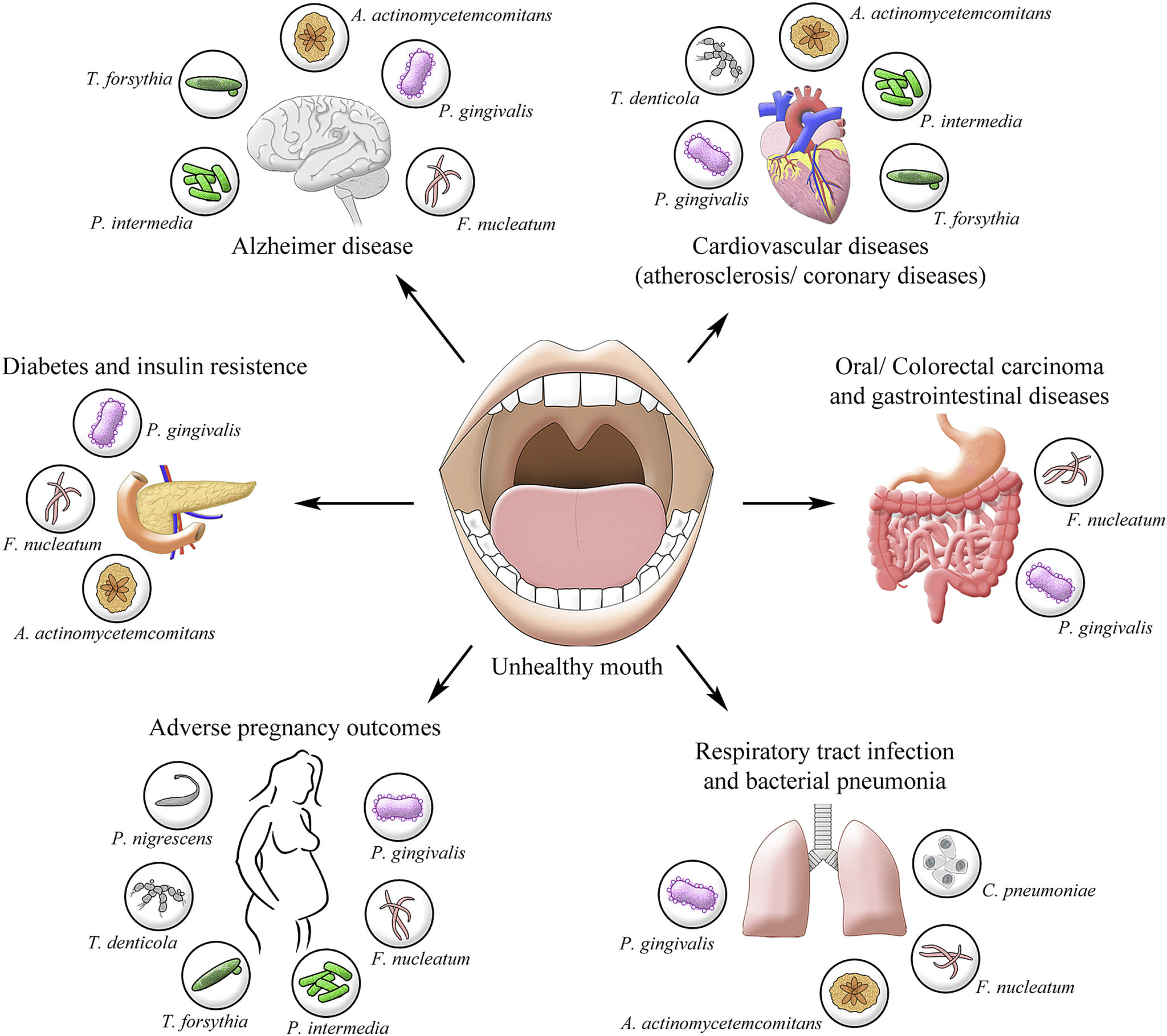 Effects of improper oral care
